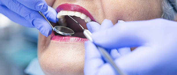 Best Knocked-Out Tooth (Avulsed Tooth) Treatment in Waukegan, IL